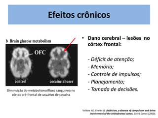 Efeitos crônicos
• Dano cerebral – lesões no
córtex frontal:
- Déficit de atenção;
- Memória;
- Controle de impulsos;
- Planejamento;
- Tomada de decisões.
Diminuição do metabolismo/fluxo sanguíneo no
córtex pré-frontal de usuários de cocaína
Volkow ND, Fowler JS. Addiction, a disease of compulsion and drive:
involvement of the orbitofrontal cortex. Cereb Cortex (2000).
 
