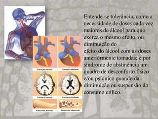 Entende-se tolerância, como a
necessidade de doses cada vez
maiores de álcool para que
exerça o mesmo efeito, ou
diminuição do
efeito do álcool com as doses
anteriormente tomadas; e por
síndrome de abstinência um
quadro de desconforto físico
e/ou psíquico quando da
diminuição ou suspensão do
consumo etílico.
 