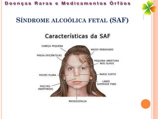 SÍNDROME ALCOÓLICA FETAL (SAF)
 