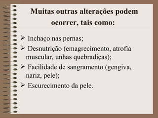 Muitas outras alterações podem
        ocorrer, tais como:
 Inchaço nas pernas;
 Desnutrição (emagrecimento, atrofia
 muscular, unhas quebradiças);
 Facilidade de sangramento (gengiva,
 nariz, pele);
 Escurecimento da pele.
 