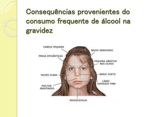 Consequências provenientes do
consumo frequente de álcool na
gravidez
 