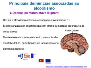 Principais demências associadas ao
alcoolismo
■ Doença de Marchiafava-Bignami
Devida a alcoolismo crónico e consequente avitaminose B1.
É caracterizada por encefalopatia com atrofia ou necrose progressiva do
corpo caloso.
Manifesta-se com entorpecimento,com confusão
mental e delírio, perturbações do tono muscular e
paralisias oculares .
http://www.cerebromente.org.br/n15/mente/lateralidade.html
 