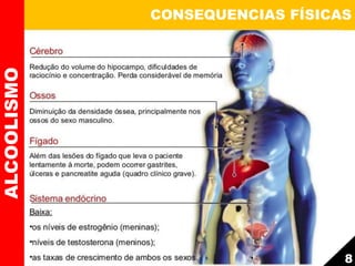 CONSEQUENCIAS FÍSICASALCOOLISMO
8
 