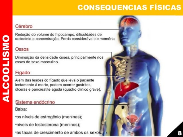 Allen Carrhae um modo fácil de deixar de beber um MP3