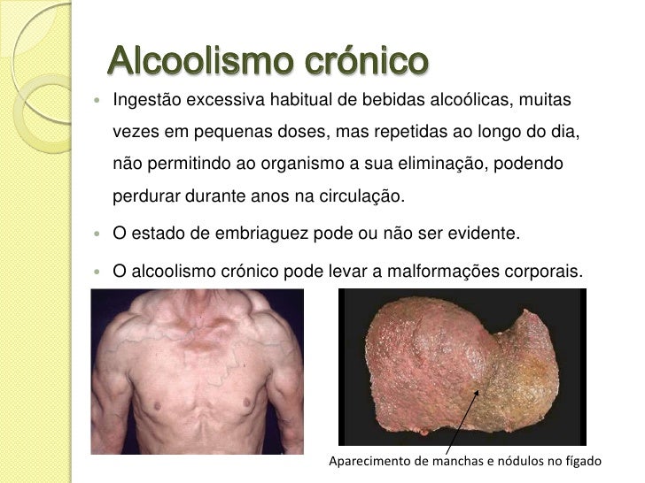 Como escrever a carta ao marido que bebe