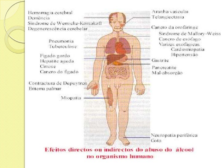 O que pode ser aplicado da dependência alcoólica