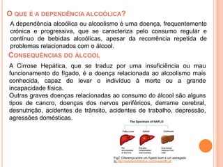 O que é a dependência alcoólica?A dependência alcoólica ou alcoolismo é uma doença, frequentemente crónica e progressiva, que se caracteriza pelo consumo regular e contínuo de bebidas alcoólicas, apesar da recorrência repetida de problemas relacionados com o álcool.Consequências do álcoolA Cirrose Hepática, que se traduz por uma insuficiência ou mau funcionamento do fígado, é a doença relacionada ao alcoolismo mais conhecida, capaz de levar o indivíduo à morte ou a grande incapacidade física.Outras graves doenças relacionadas ao consumo do álcool são alguns tipos de cancro, doenças dos nervos periféricos, derrame cerebral, desnutrição, acidentes de trânsito, acidentes de trabalho, depressão, agressões domésticas.In: http://dietplanforfattyliver.com/images/fld.gifFig2. Diferença entre um fígado bom e um estragado