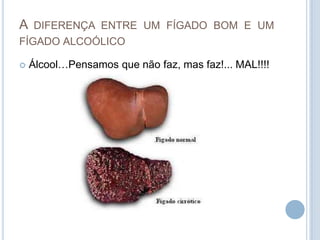 A diferença entre um fígado bom e um fígado alcoólicoÁlcool…Pensamos que não faz, mas faz!... MAL!!!!