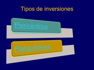 Tipos de inversiones
 
