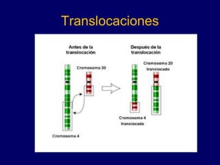 Translocaciones
 