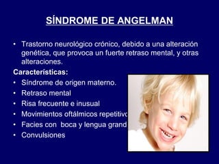 SÍNDROME DE ANGELMAN
• Trastorno neurológico crónico, debido a una alteración
genética, que provoca un fuerte retraso mental, y otras
alteraciones.
Características:
• Síndrome de origen materno.
• Retraso mental
• Risa frecuente e inusual
• Movimientos oftálmicos repetitivos
• Facies con boca y lengua grande
• Convulsiones
 