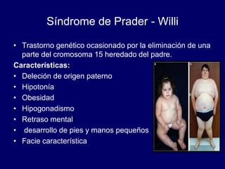 Síndrome de Prader - Willi
• Trastorno genético ocasionado por la eliminación de una
parte del cromosoma 15 heredado del padre.
Características:
• Deleción de origen paterno
• Hipotonía
• Obesidad
• Hipogonadismo
• Retraso mental
• desarrollo de pies y manos pequeños
• Facie característica
 