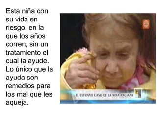Esta niña con
su vida en
riesgo, en la
que los años
corren, sin un
tratamiento el
cual la ayude.
Lo único que la
ayuda son
remedios para
los mal que les
aqueja.
 