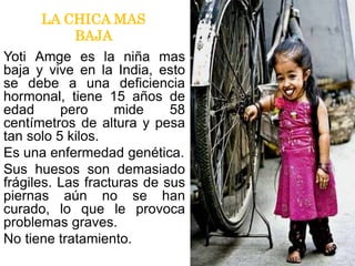 LA CHICA MAS
BAJA
Yoti Amge es la niña mas
baja y vive en la India, esto
se debe a una deficiencia
hormonal, tiene 15 años de
edad pero mide 58
centímetros de altura y pesa
tan solo 5 kilos.
Es una enfermedad genética.
Sus huesos son demasiado
frágiles. Las fracturas de sus
piernas aún no se han
curado, lo que le provoca
problemas graves.
No tiene tratamiento.
 
