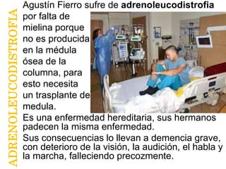 ADRENOLEUCODISTROFIA
Agustín Fierro sufre de adrenoleucodistrofia
por falta de
mielina porque
no es producida
en la médula
ósea de la
columna, para
esto necesita
un trasplante de
medula.
Es una enfermedad hereditaria, sus hermanos
padecen la misma enfermedad.
Sus consecuencias lo llevan a demencia grave,
con deterioro de la visión, la audición, el habla y
la marcha, falleciendo precozmente.
 