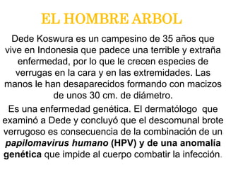 EL HOMBRE ARBOL
Dede Koswura es un campesino de 35 años que
vive en Indonesia que padece una terrible y extraña
enfermedad, por lo que le crecen especies de
verrugas en la cara y en las extremidades. Las
manos le han desaparecidos formando con macizos
de unos 30 cm. de diámetro.
Es una enfermedad genética. El dermatólogo que
examinó a Dede y concluyó que el descomunal brote
verrugoso es consecuencia de la combinación de un
papilomavirus humano (HPV) y de una anomalía
genética que impide al cuerpo combatir la infección.
 