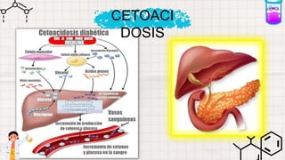 CETOACI
DOSIS
 
