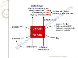 Alcohol induced liver diseases 13
 