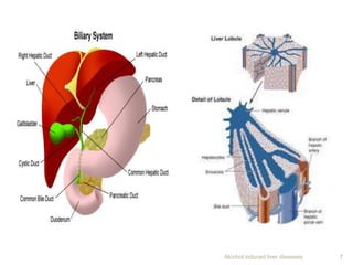 Alcohol induced liver diseases 7
 