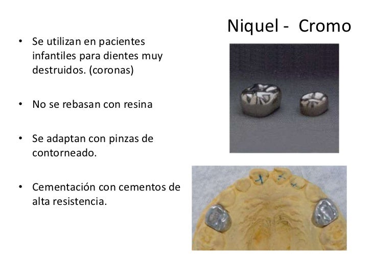 Aleaciones para restauraciones dentales Aleaciones para restauraciones dentales