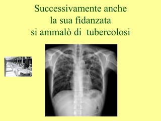 Successivamente anche
la sua fidanzata
si ammalò di tubercolosi
 