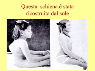 Questa schiena è stata
ricostruita dal sole
 