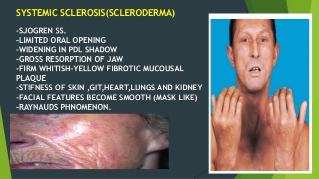 Allergy and autoimmune diseases in dentistry