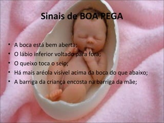 Sinais de BOA PEGA

•   A boca está bem aberta;
•   O lábio inferior voltado para fora;
•   O queixo toca o seio;
•   Há mais aréola visível acima da boca do que abaixo;
•   A barriga da criança encosta na barriga da mãe;
 