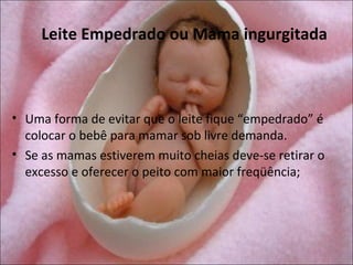 Leite Empedrado ou Mama ingurgitada



• Uma forma de evitar que o leite fique “empedrado” é
  colocar o bebê para mamar sob livre demanda.
• Se as mamas estiverem muito cheias deve-se retirar o
  excesso e oferecer o peito com maior freqüência;
 