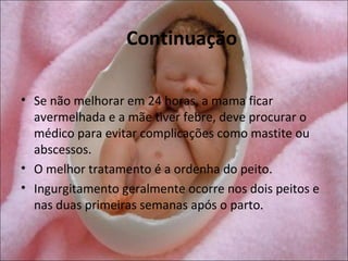 Continuação

• Se não melhorar em 24 horas, a mama ficar
  avermelhada e a mãe tiver febre, deve procurar o
  médico para evitar complicações como mastite ou
  abscessos.
• O melhor tratamento é a ordenha do peito.
• Ingurgitamento geralmente ocorre nos dois peitos e
  nas duas primeiras semanas após o parto.
 