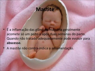 Mastite


• É a inflamação das glândula mamária geralmente
  acomete só um peito e após duas semanas do parto.
  Quando não tratado adequadamente pode evoluir para
  abscesso.
• A mastite não contra-indica a amamentação.
 