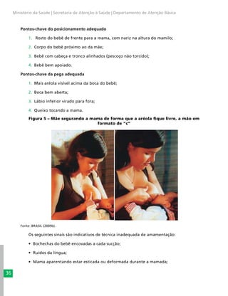 36
Ministério da Saúde | Secretaria de Atenção à Saúde | Departamento de Atenção Básica
Pontos-chave do posicionamento adequado
1.	 Rosto do bebê de frente para a mama, com nariz na altura do mamilo;
2.	 Corpo do bebê próximo ao da mãe;
3.	 Bebê com cabeça e tronco alinhados (pescoço não torcido);
4.	 Bebê bem apoiado.
Pontos-chave da pega adequada
1.	 Mais aréola visível acima da boca do bebê;
2.	 Boca bem aberta;
3.	 Lábio inferior virado para fora;
4.	 Queixo tocando a mama.
Figura 5 – Mãe segurando a mama de forma que a aréola fique livre, a mão em
formato de “c”
Fonte: BRASIL (2009b).
Os seguintes sinais são indicativos de técnica inadequada de amamentação:
•	 Bochechas do bebê encovadas a cada sucção;
•	 Ruídos da língua;
•	 Mama aparentando estar esticada ou deformada durante a mamada;
 