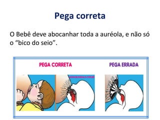 Pega correta
O Bebê deve abocanhar toda a auréola, e não só
o “bico do seio”.
 