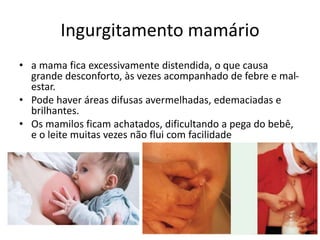 Ingurgitamento mamário
• a mama fica excessivamente distendida, o que causa
grande desconforto, às vezes acompanhado de febre e mal-
estar.
• Pode haver áreas difusas avermelhadas, edemaciadas e
brilhantes.
• Os mamilos ficam achatados, dificultando a pega do bebê,
e o leite muitas vezes não flui com facilidade
 