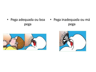 • Pega adequada ou boa
pega
• Pega inadequada ou má
pega
 