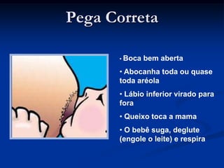 Pega Correta

      • Boca   bem aberta
      • Abocanha toda ou quase
      toda aréola
      • Lábio inferior virado para
      fora
      • Queixo toca a mama
      • O bebê suga, deglute
      (engole o leite) e respira
 