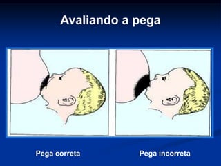 Avaliando a pega




Pega correta      Pega incorreta
 