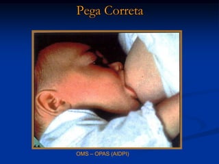 Pega Correta




OMS – OPAS (AIDPI)
 