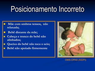 Posicionamento Incorreto
    Mãe com ombros tensos, não
    relaxada;
    Bebê distante da mãe;
   Cabeça e tronco do bebê não
    alinhados;
   Queixo do bebê não toca o seio;
   Bebê não apoiado firmemente


                                      OMS-OPAS (AIDPI)
 
