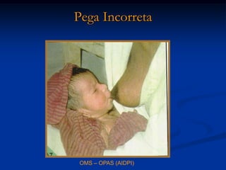 Pega Incorreta




 OMS – OPAS (AIDPI)
 