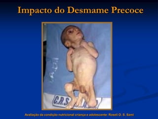 Impacto do Desmame Precoce




 Avaliação da condição nutricional criança e adolescente: Roseli O. S. Sami
 