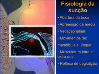 Fisiologia da
     sucção
• Abertura da boca
• Apreensão da aréola
• Vedação labial
• Movimentos de:
mandíbula e língua
• Musculatura intra e
extra oral
• Reflexo de deglutição
 