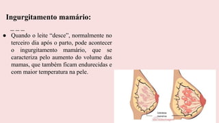 ● Quando o leite “desce”, normalmente no
terceiro dia após o parto, pode acontecer
o ingurgitamento mamário, que se
caracteriza pelo aumento do volume das
mamas, que também ficam endurecidas e
com maior temperatura na pele.
Ingurgitamento mamário:
 