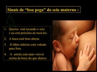 Sinais de “boa pega” do seio materno :
1. Queixo está tocando o seio
( ou está próximo de tocá-lo)
2. A boca está bem aberta
3. O lábio inferior está voltado
para fora.
4. A aréola está mais visível
acima da boca do que abaixo
 