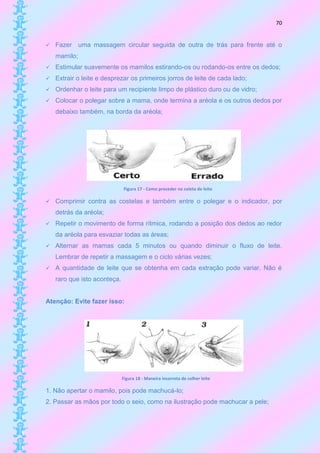 70


   Fazer uma massagem circular seguida de outra de trás para frente até o
    mamilo;
   Estimular suavemente os mamilos estirando-os ou rodando-os entre os dedos;
   Extrair o leite e desprezar os primeiros jorros de leite de cada lado;
   Ordenhar o leite para um recipiente limpo de plástico duro ou de vidro;
   Colocar o polegar sobre a mama, onde termina a aréola e os outros dedos por
    debaixo também, na borda da aréola;




                              Figura 17 - Como proceder na coleta de leite

   Comprimir contra as costelas e também entre o polegar e o indicador, por
    detrás da aréola;
   Repetir o movimento de forma rítmica, rodando a posição dos dedos ao redor
    da aréola para esvaziar todas as áreas;
   Alternar as mamas cada 5 minutos ou quando diminuir o fluxo de leite.
    Lembrar de repetir a massagem e o ciclo várias vezes;
   A quantidade de leite que se obtenha em cada extração pode variar. Não é
    raro que isto aconteça.


Atenção: Evite fazer isso:




                              Figura 18 - Maneira incorreta de colher leite

1. Não apertar o mamilo, pois pode machucá-lo;
2. Passar as mãos por todo o seio, como na ilustração pode machucar a pele;
 