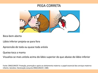 PEGA CORRETA
Boca bem aberta
Lábio inferior projeta-se para fora
Apreensão de toda ou quase toda aréola
Queixo toca a mama
Visualiza-se mais aréola acima do lábio superior do que abaixo do lábio inferior
Fonte: OMS/UNICEF. Proteção, promoção e apoio ao aleitamento materno: o papel essencial dos serviços materno-
infantis. Genebra: Declaração conjunta OMS/UNICEF; 1989.
 