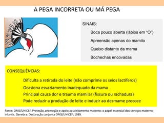 A PEGA INCORRETA OU MÁ PEGA
CONSEQUÊNCIAS:
Dificulta a retirada do leite (não comprime os seios lactíferos)
Ocasiona esvaziamento inadequado da mama
Principal causa dor e trauma mamilar (fissura ou rachadura)
Pode reduzir a produção de leite e induzir ao desmame precoce
Fonte: OMS/UNICEF. Proteção, promoção e apoio ao aleitamento materno: o papel essencial dos serviços materno-
infantis. Genebra: Declaração conjunta OMS/UNICEF; 1989.
SINAIS:
Boca pouco aberta (lábios em “O”)
Apreensão apenas do mamilo
Queixo distante da mama
Bochechas encovadas
 