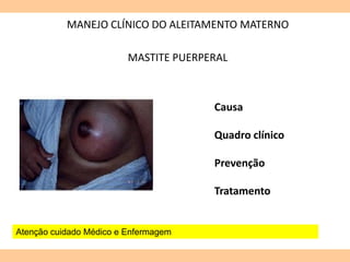 MANEJO CLÍNICO DO ALEITAMENTO MATERNO
MASTITE PUERPERAL
Causa
Quadro clínico
Prevenção
Tratamento
Atenção cuidado Médico e Enfermagem
 