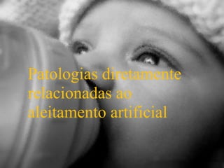Patologias diretamente
relacionadas ao
aleitamento artificial
 