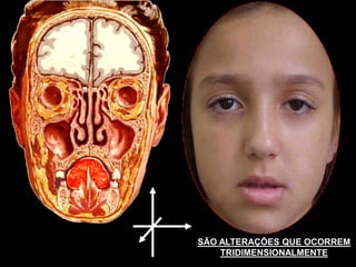 SÃO ALTERAÇÕES QUE OCORREM
    TRIDIMENSIONALMENTE
 